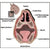 Nasal Flair Strips - 6 Pack